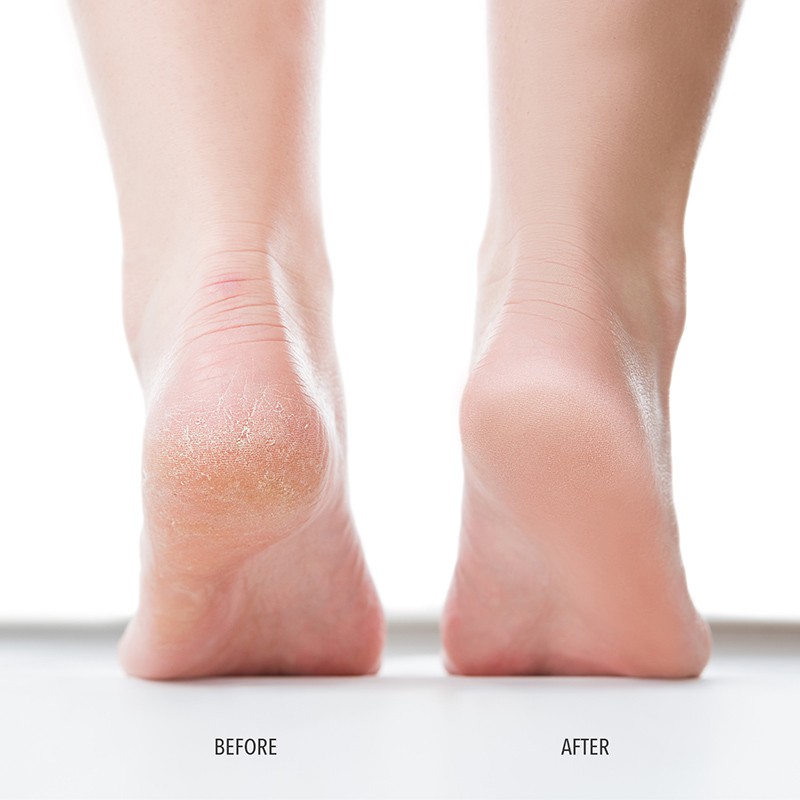 FOOT SCRUB