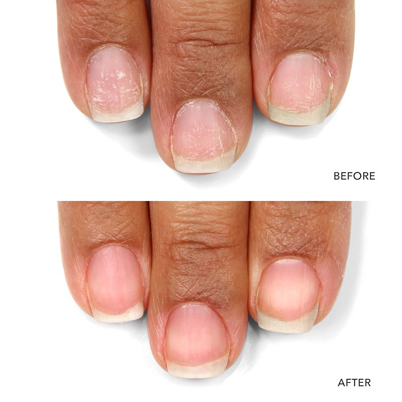 Kur® Nail Probiotic Instant Boost