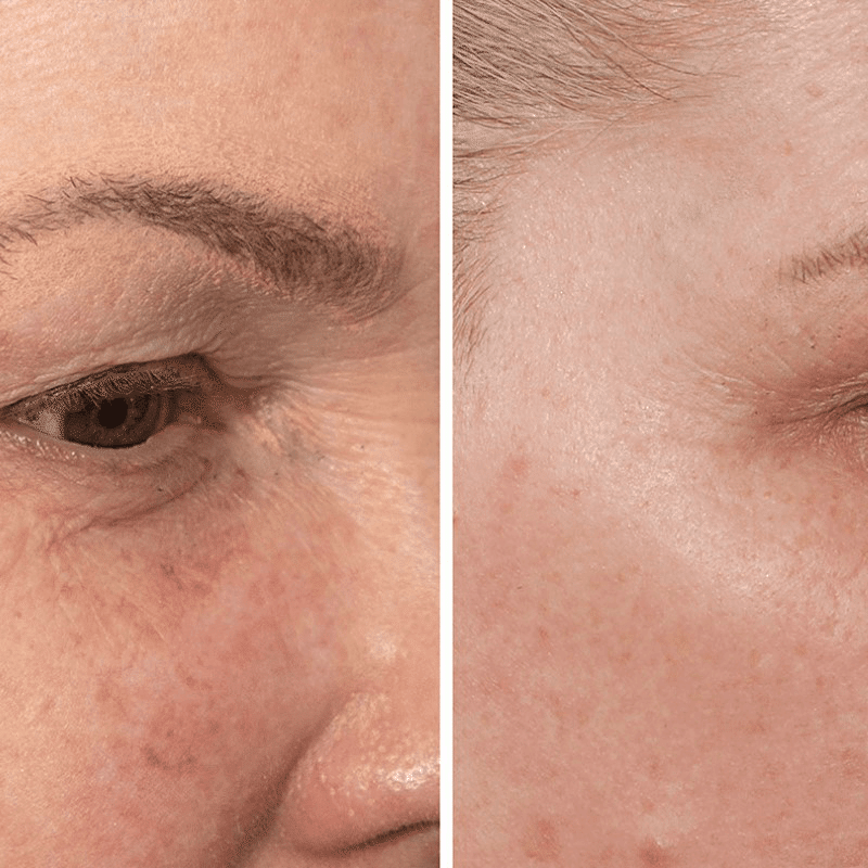 Firm & Brighten Under Eye Gels (10 Pairs)