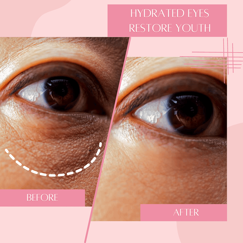 Reusable Hydrating Under Eye Mask