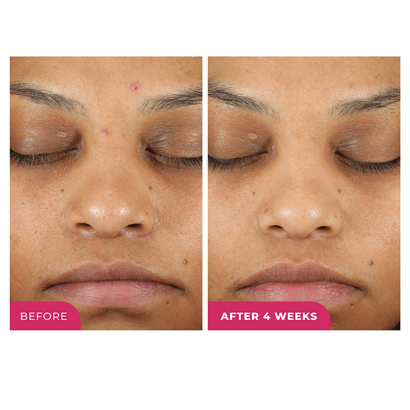 Triple Action Daily Peel Pads