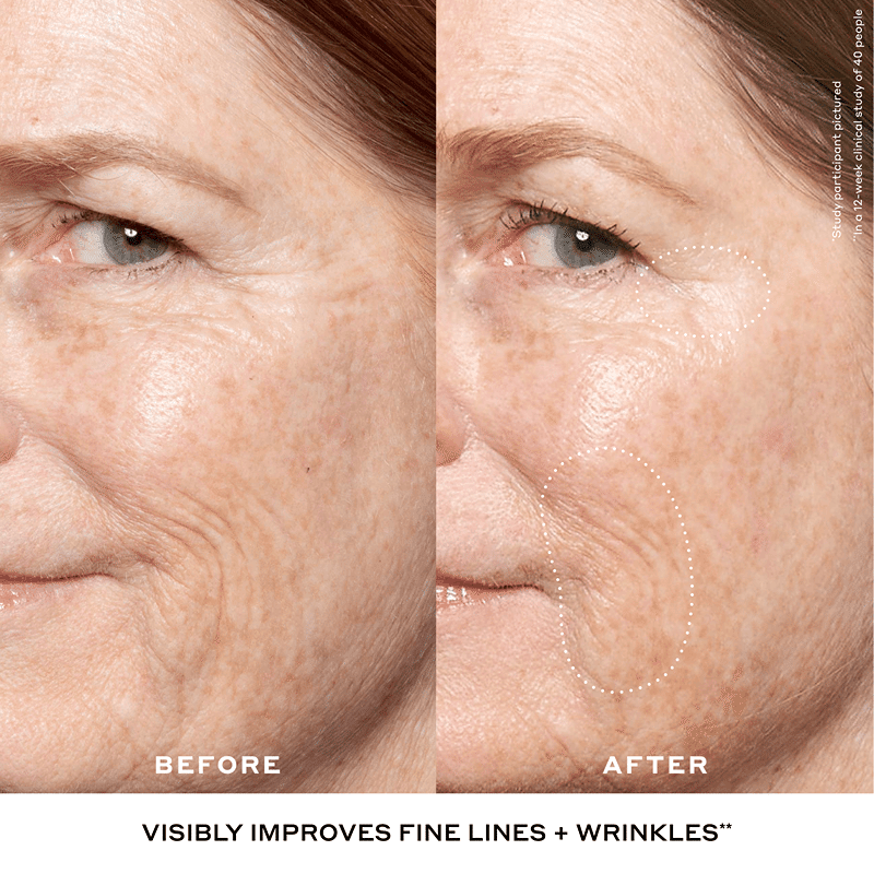 Double Rewind Retinol Serum