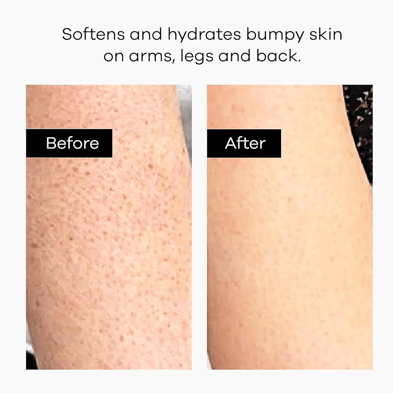 Deep Exfoliating Body Lotion