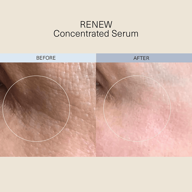 RENEW Concentrated Serum