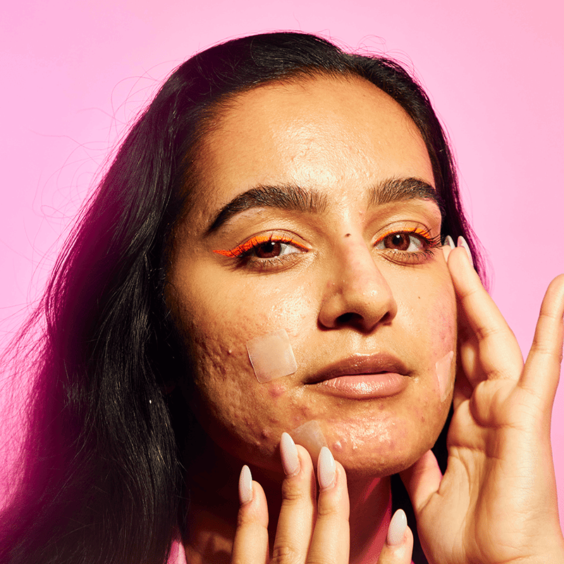 Hyperpigmentation Pimple Patches
