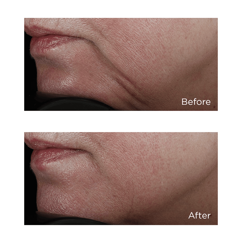 High Potency Classics Face Firming Serum