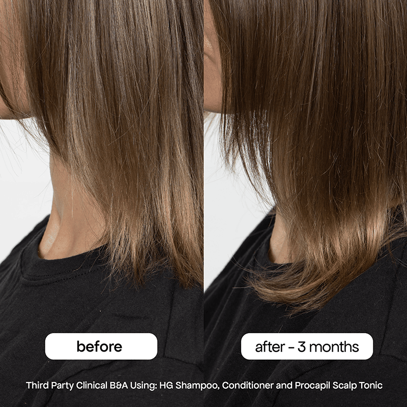 HG Anti-Thinning Procapil Scalp Tonic