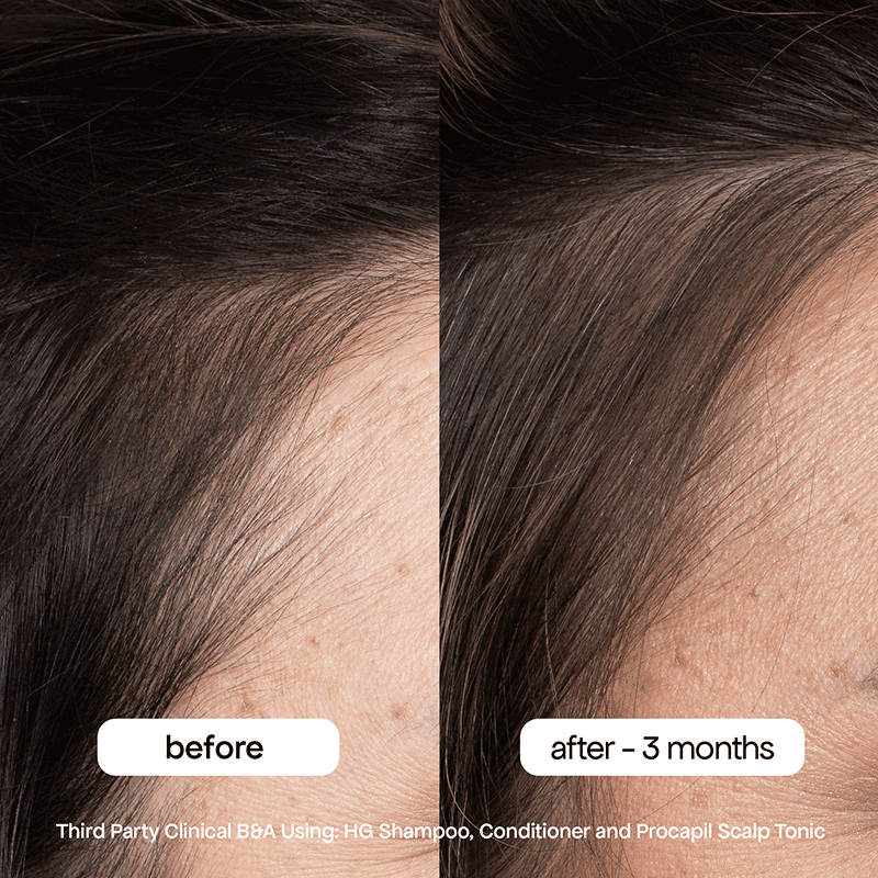 HG Anti-Thinning Procapil Scalp Tonic