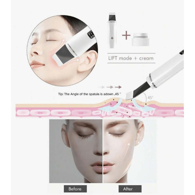 Ultrasonic Facial Spatula
