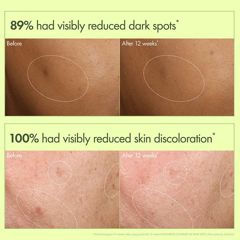 Mega Mushroom Dark Spot Brightening Serum