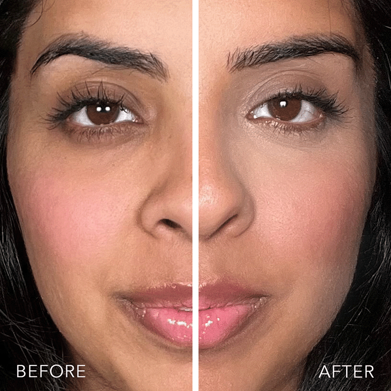 Genius Tinted Under Eye Treatment Trio