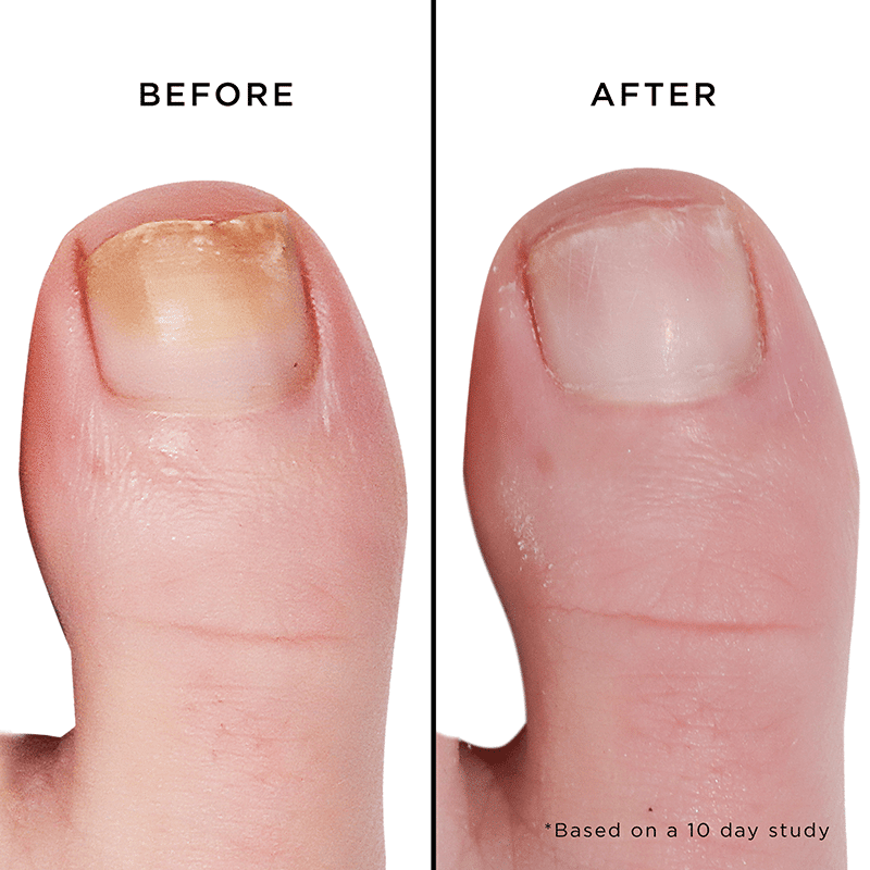 Mellow The Yellow Nail Brightening Treatment