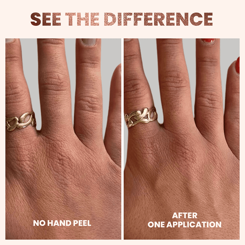 Rose Gold Hand Peel
