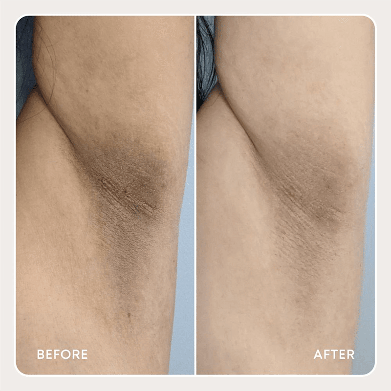 Bermuda Dark Spot Oil