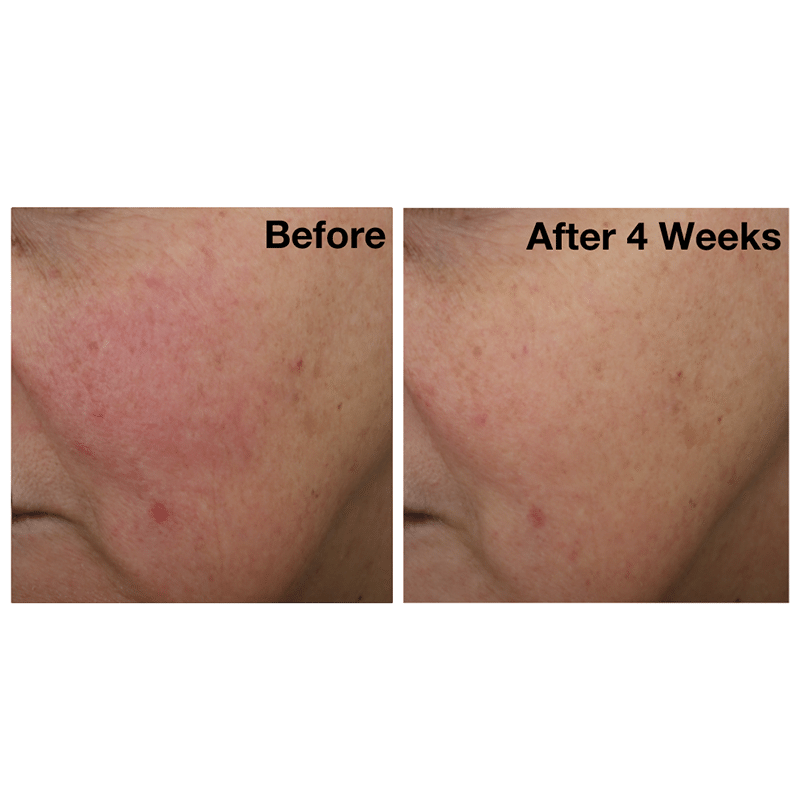 The Catalyst Intense Renewing Serum