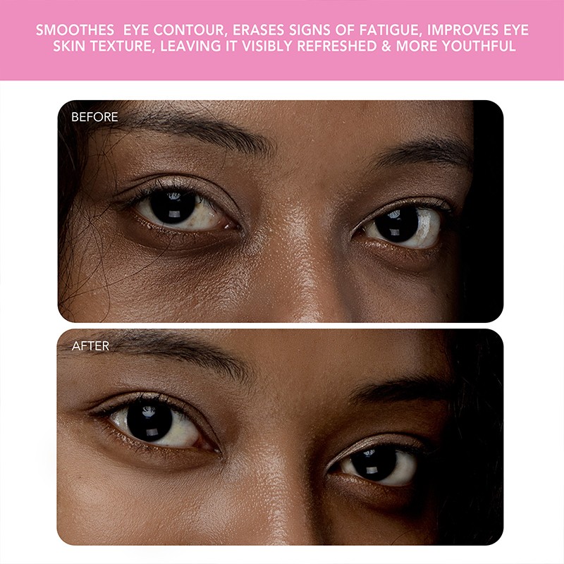 Iris2 Eye Massager