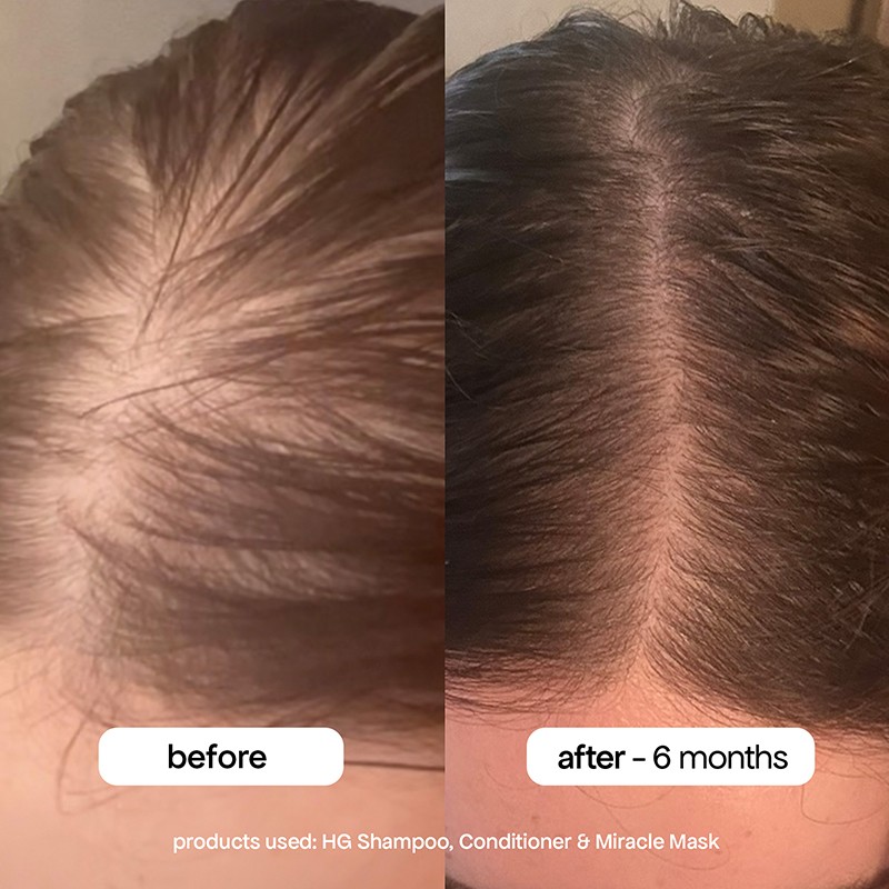 Miracle Hair Mask