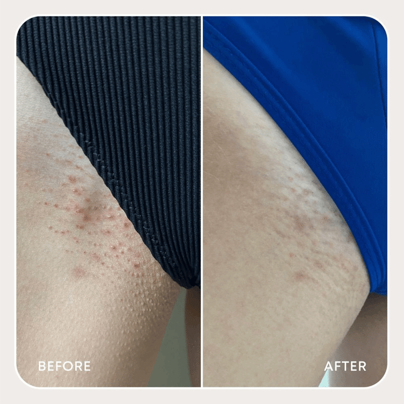 Limited Edition Berry Crush Ingrown Hair Exfoliating Scrub