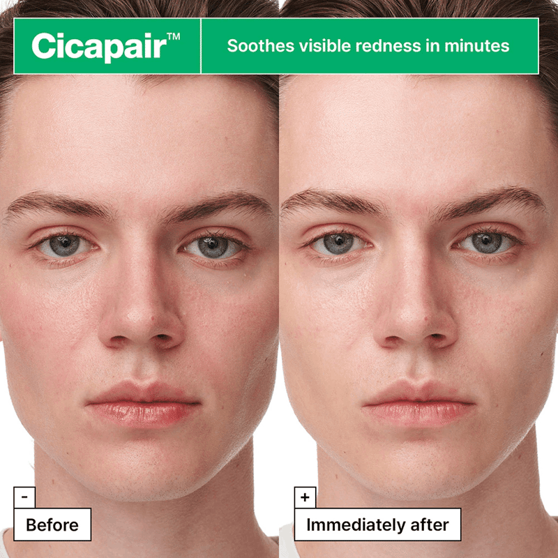 Cicapair™ Sensitive Skin Serum Face Mask for Redness 5 Pack