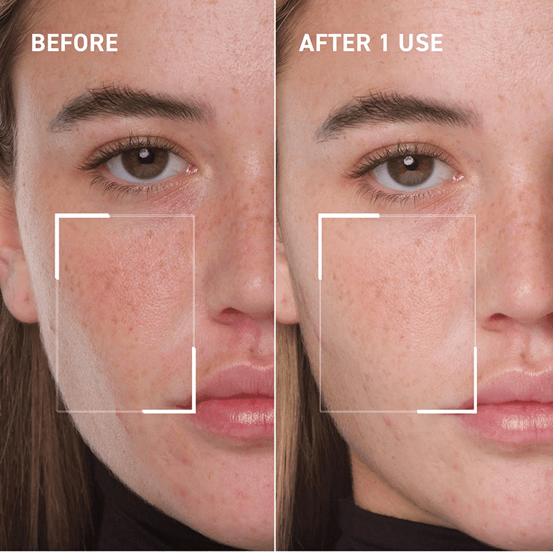 Confidence Veil Mask