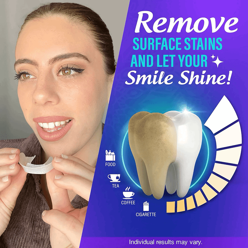 Professional Whitening Trays - 7 Treatments