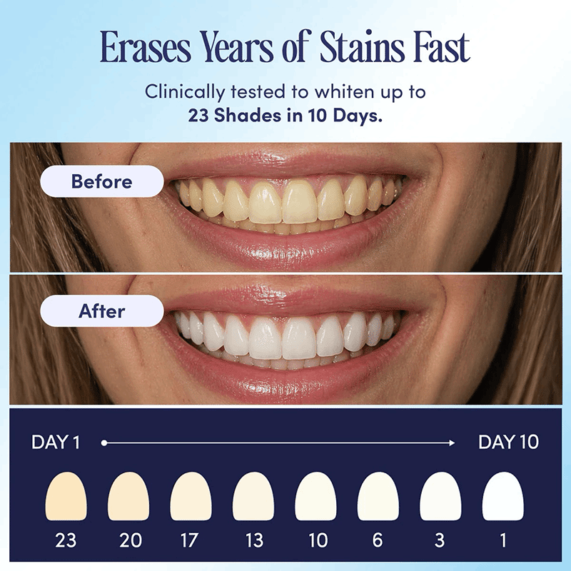 Teeth Whitening U-Wraps
