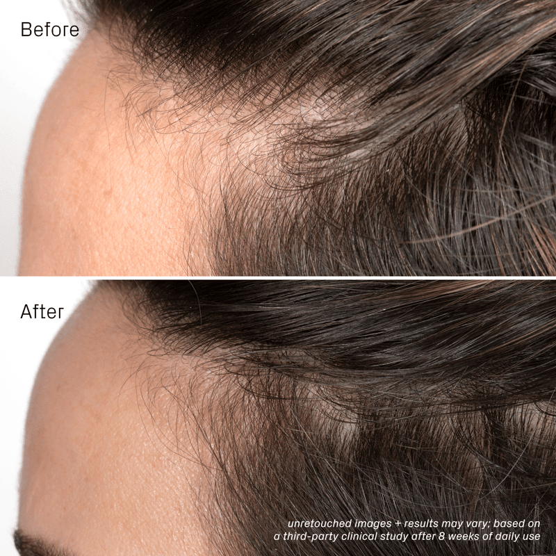 Iconic Densifying Scalp Serum
