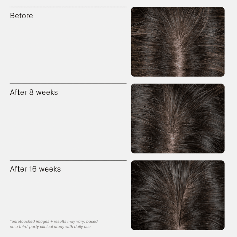 Iconic Densifying Scalp Serum
